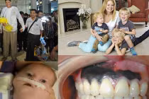 Những chứng bệnh ung thư kỳ quặc