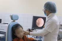 Báo động những vụ trẻ nhét dị vật vào tai, mũi kinh hoàng