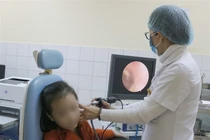 Báo động những vụ trẻ nhét dị vật vào tai, mũi kinh hoàng