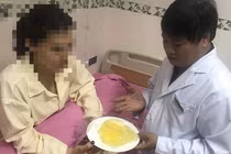 “Sợ tái mặt” trước những vụ vỡ túi ngực kinh hoàng