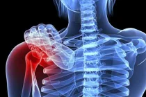 Những cơn đau thường gặp ở bệnh nhân ung thư