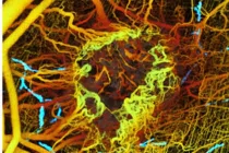 Khám phá hoạt động của ung thư qua ảnh quang mới