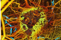 Khám phá hoạt động của ung thư qua ảnh quang mới