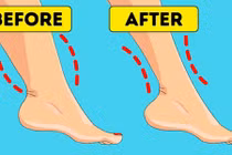 7 mẹo sở hữu đôi chân thon thả tự tin diện váy mùa hè