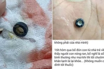 Hoảng hồn bé nhỏ sốt liên tục sau khi nhà trẻ vì lý do kinh khủng này