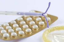 Tác dụng bất ngờ của vòng tránh thai với bệnh ung thư 
