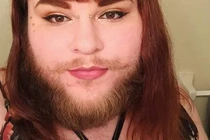 Khuôn mặt gây sốc của cô gái vài tháng không cạo râu