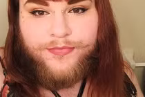 Khuôn mặt gây sốc của cô gái vài tháng không cạo râu