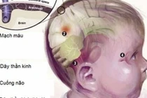 Trẻ bị tổn thương não vĩnh viễn vì những thói quen vô tâm của cha mẹ