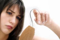 Lý do nào khiến tóc rụng như mưa