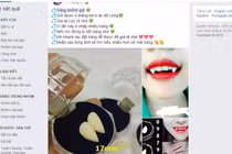 Nguy hiểm tiềm ẩn từ trào lưu mua răng khểnh giả tự lắp