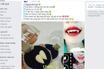 Nguy hiểm tiềm ẩn từ trào lưu mua răng khểnh giả tự lắp