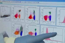 Tế bào miễn dịch có thể tăng nguy cơ ung thư vú