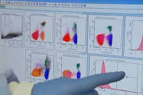 Tế bào miễn dịch có thể tăng nguy cơ ung thư vú