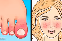 Những dấu hiệu suy giảm hệ miễn dịch bạn cần thận trọng