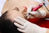 Cảnh báo: Nhiễm virus viêm gan từ xăm môi, xăm mày