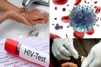 Ngay khi phát hiện phơi nhiễm HIV, cần phải làm gì?