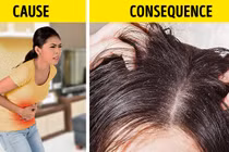 Dấu hiệu mái tóc cảnh báo sức khoẻ bạn có vấn đề