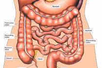 Những dấu hiệu phát hiện sớm ung thư ruột