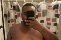 Chết lặng lý do chồng không dám cởi áo khi “yêu” vợ 