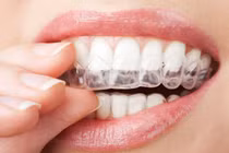 Để nụ cười xinh, học ngay những thói quen ngừa sâu răng từ nha sĩ 