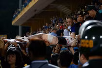 Fan nữ trúng pháo sáng CĐV Nam Định: Di chứng, phục hồi chức năng ra sao?