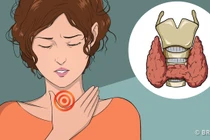 Nếu có những dấu hiệu này, bạn phải đi khám ngay tuyến giáp 