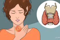 Nếu có những dấu hiệu này, bạn phải đi khám ngay tuyến giáp 
