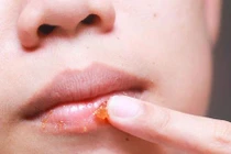 Mẹo giúp môi không bị nhiễm chì khi đánh son