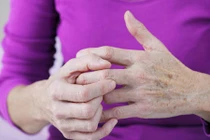 Ngăn ngừa viêm khớp, tránh 8 thực phẩm sau ngay từ bây giờ