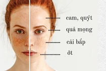 Làn da đẹp như mơ nhờ chọn đúng chế độ ăn phù hợp loại da