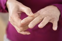 7 lý do khiến ngón tay bạn sưng phù