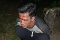 Bắt đối tượng trộm gỗ sưa, hai cảnh sát có nguy cơ phơi nhiễm HIV