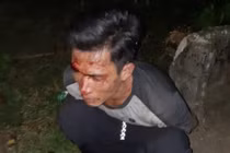 Bắt đối tượng trộm gỗ sưa, hai cảnh sát có nguy cơ phơi nhiễm HIV