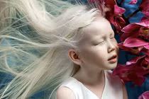 Ngạc nhiên vẻ ngoài khác thường của những đứa trẻ đặc biệt