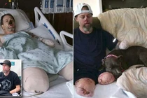 Bị chó liếm chân, người đàn ông cụt tay cụt chân vĩnh viễn