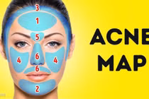 Đoán bệnh chuẩn từ vị trí mọc mụn trứng cá trên mặt 