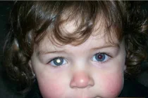 Đừng bỏ qua chấm trắng trong mắt bé