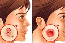 7 xét nghiệm phòng bệnh nguy hiểm, người lớn nào cũng nên làm