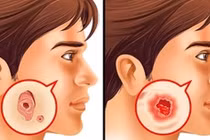 7 xét nghiệm phòng bệnh nguy hiểm, người lớn nào cũng nên làm