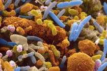 Tìm ra thủ phạm mới gây ung thư đại tràng