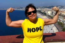 Người phụ nữ trẻ nhất mắc ung thư đại tràng 