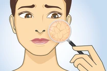 10 dấu hiệu cảnh báo cơ thể thiếu canxi trầm trọng