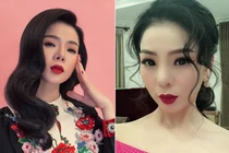 Cận cảnh những gương mặt hoại tử do nâng mũi làm đẹp