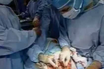 Zoom cận cảnh ca phẫu thuật ung thư vú