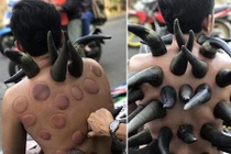 Kinh ngạc trước phương pháp chữa bệnh bằng sừng trâu 