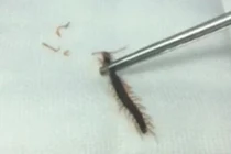 Ngủ dưới sàn nhà, rết chui vào tai bé gái ở Sài Gòn