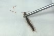 Ngủ dưới sàn nhà, rết chui vào tai bé gái ở Sài Gòn