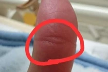 Tướng bàn tay vượng đường quý nhân