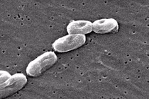 Sự thật kinh hoàng về loại vi khuẩn “ăn thịt người” đang hoành hành trở lại